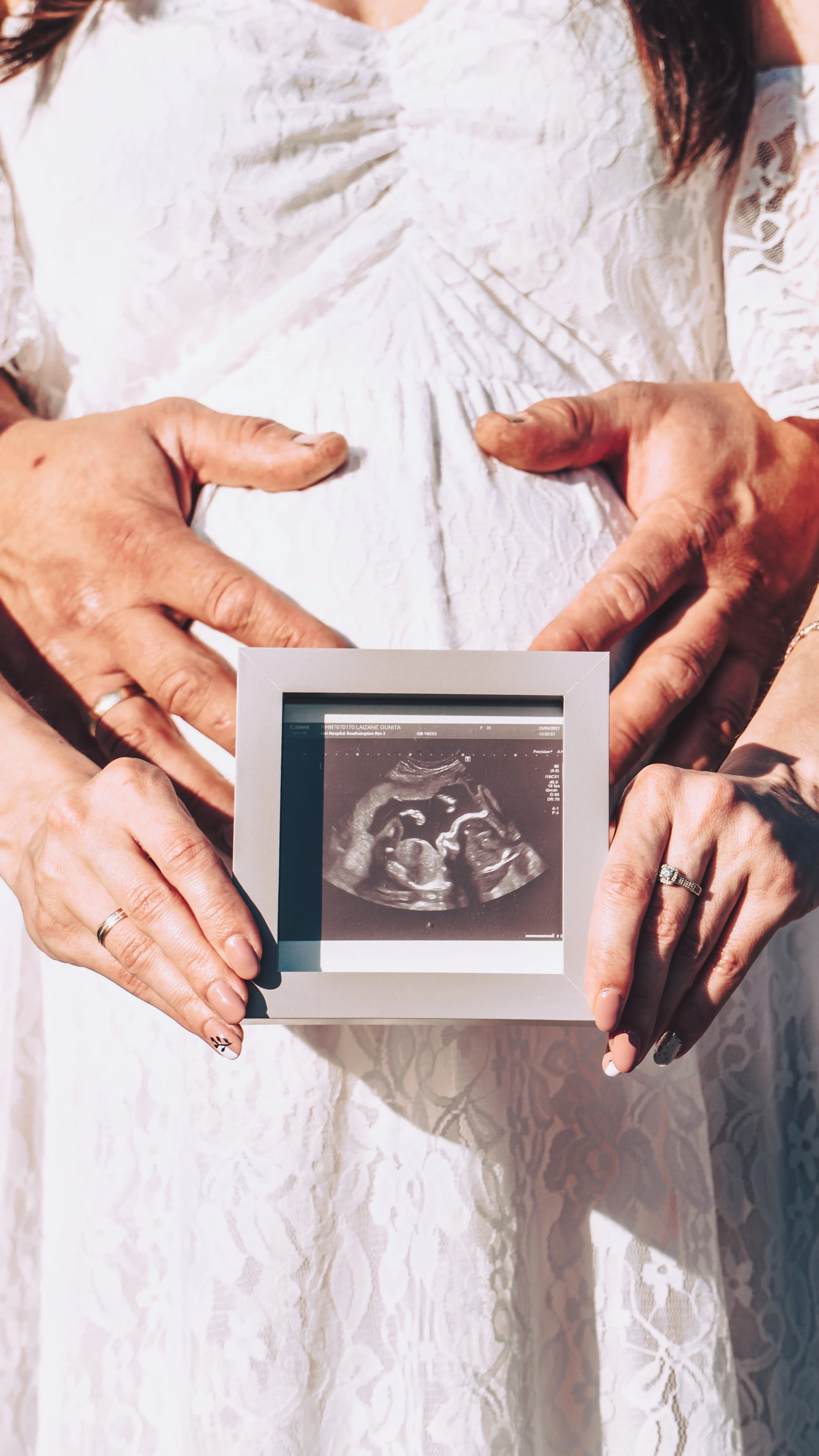 Maternity outdoor photoshoot idea , Staunton park, Havant, Portsouth, Hampshire and West Sussex, in white dress