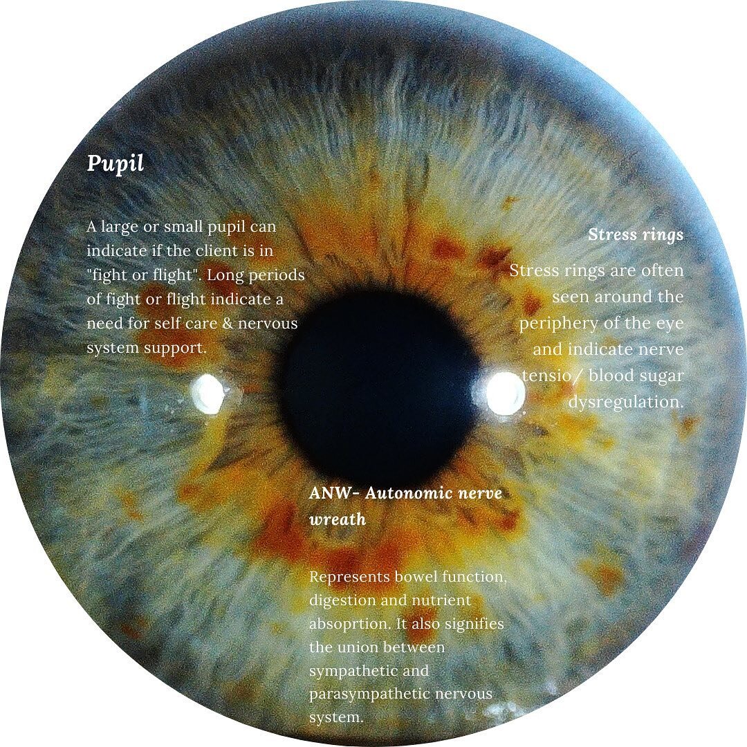 Iridology -&quot;The study of the iris to help determine the patients overall health&quot;. The size of the pupil, looking at the autonomic nerve wreath &amp; stress rings, are just some of the things we look for in the eye, to tell us more about the