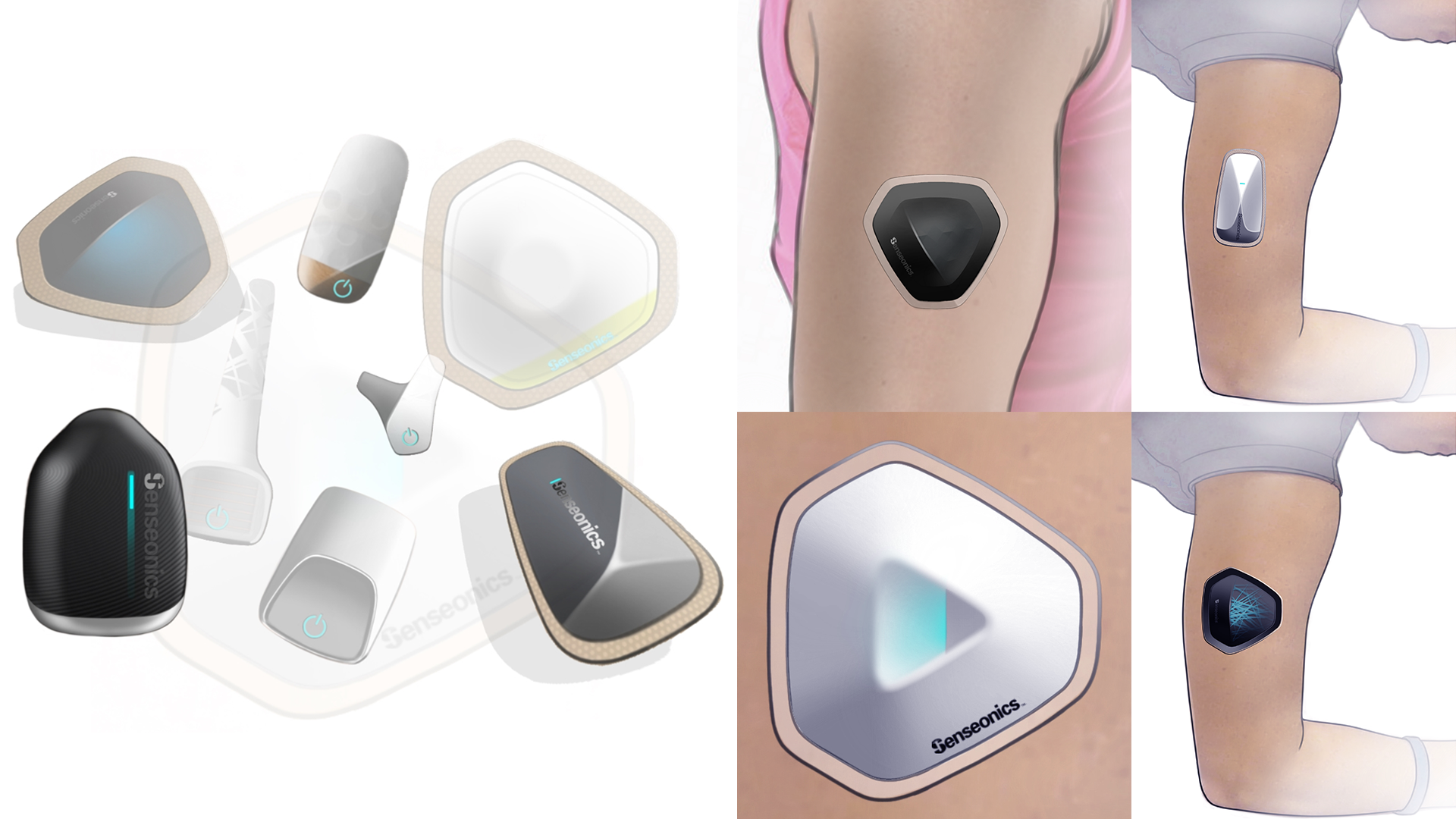 Senseonics.png