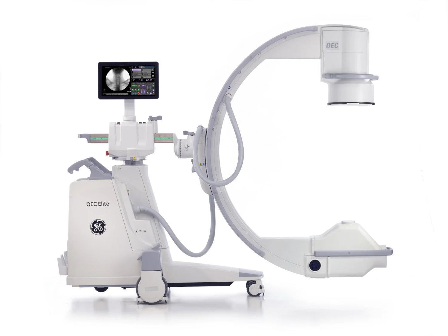 What is Fluoroscopy?