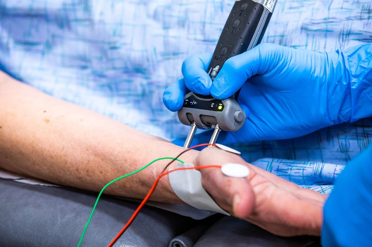 What is Electromyography/Nerve Conduction Studies (EMG/NCS?)