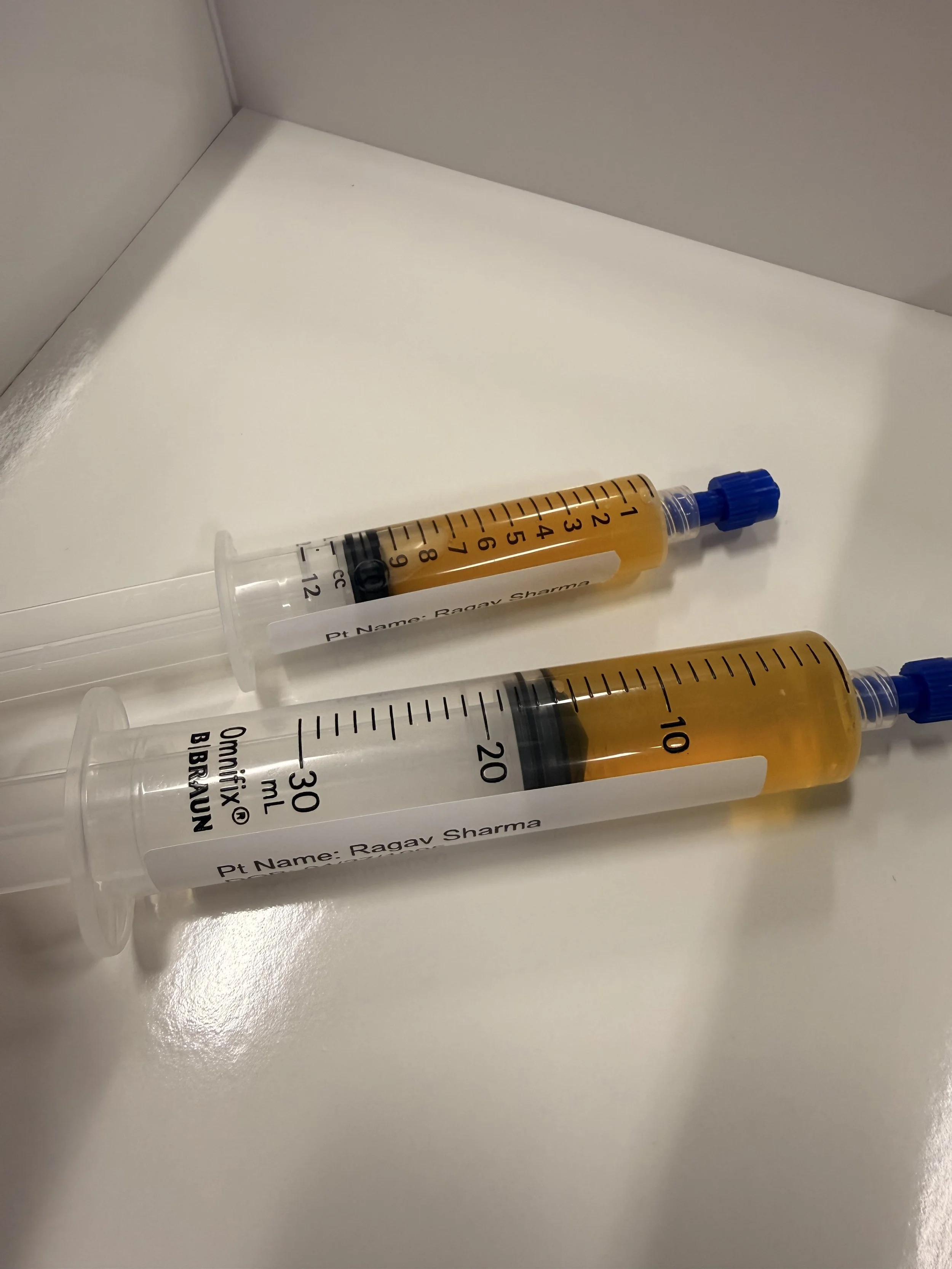 Platelet-Rich-Plasma (PRP): What You Need to Know
