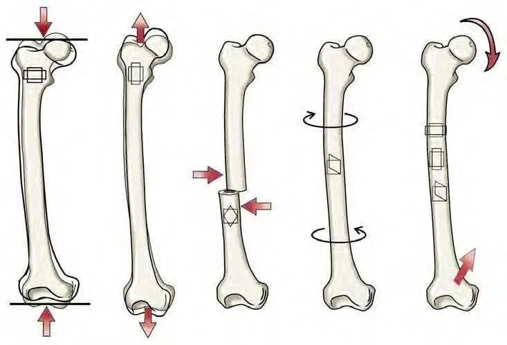Bone Health &amp; Preventing Osteoporosis