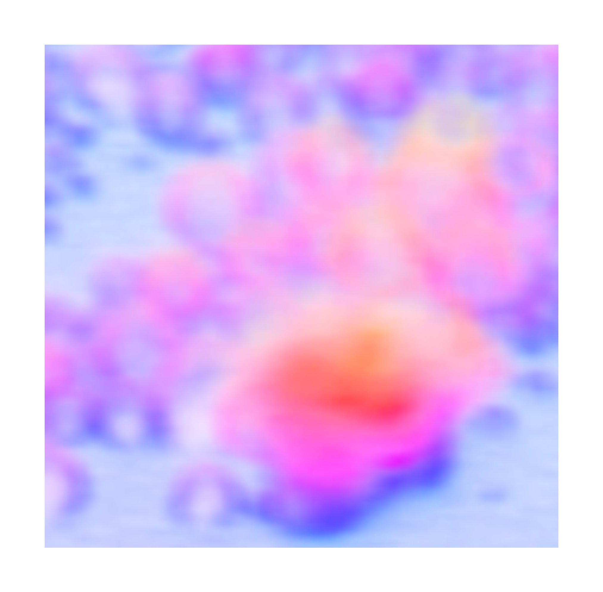 Annular pleats 环形褶皱