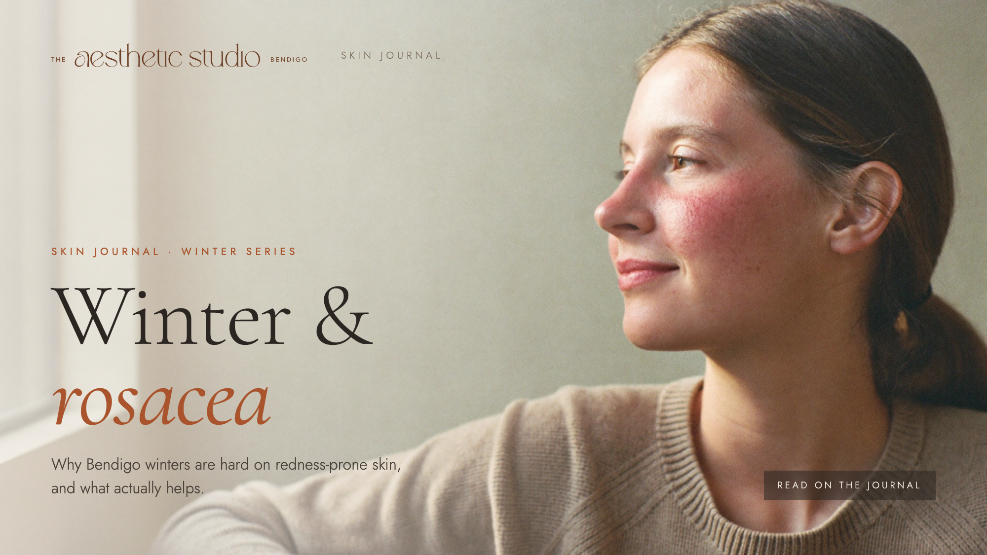 Why Winter Is Tough on Rosacea-Prone Skin in Bendigo