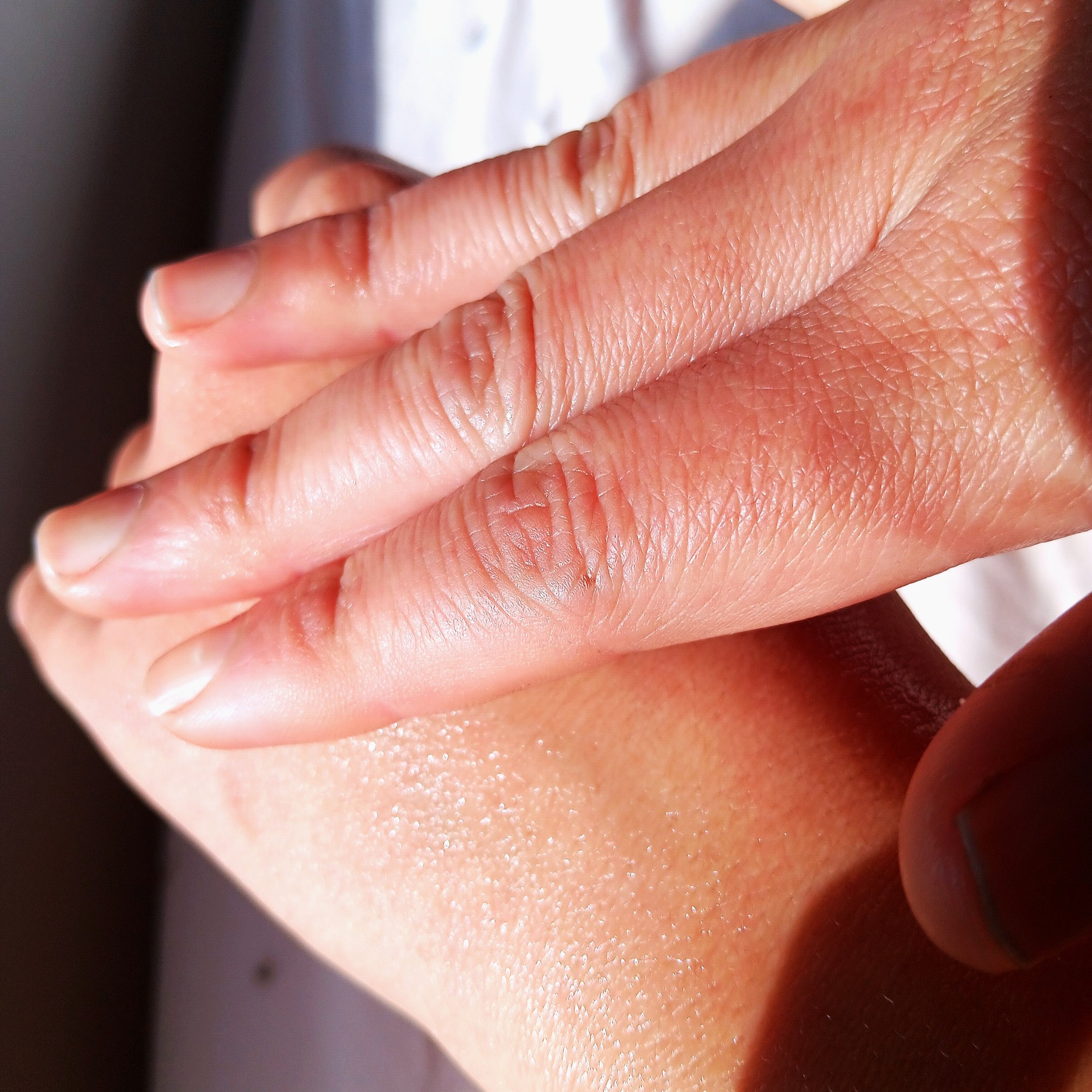This healing balm can be applied all over body to nourish skin