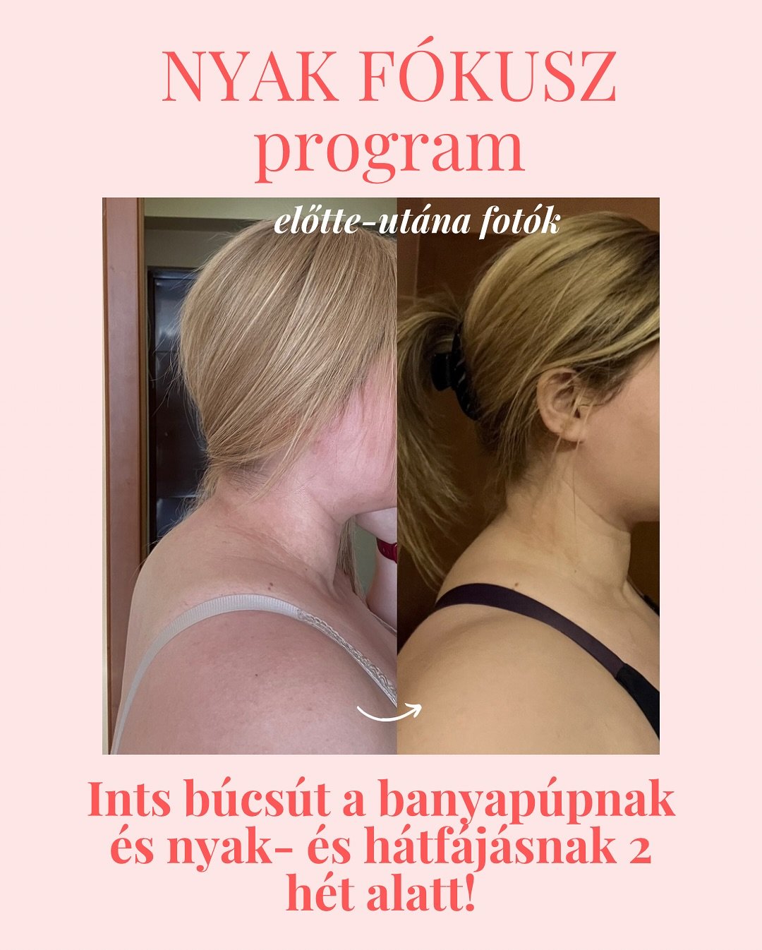 rekl&aacute;m | 💥Azt hiszem, nem kell t&uacute;l sok minden mondanom, ezek az eredm&eacute;nyek maguk&eacute;rt besz&eacute;lnek! 🥰 

Ha szeretn&eacute;l te is hasonl&oacute; eredm&eacute;nyeket, 3 dologra lesz sz&uuml;ks&eacute;ged: kitart&aacute;