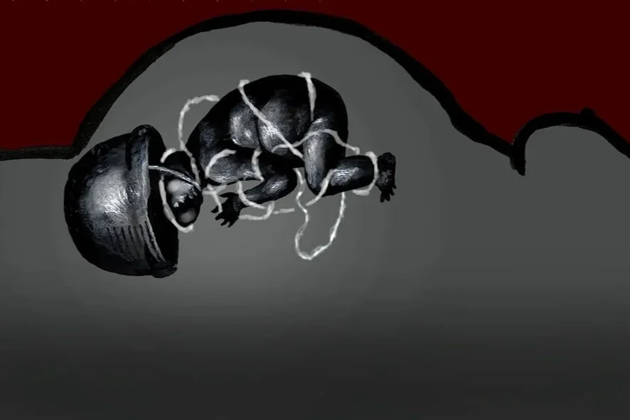 Op-ed: Don't forget the children born of the war violence in Ukraine