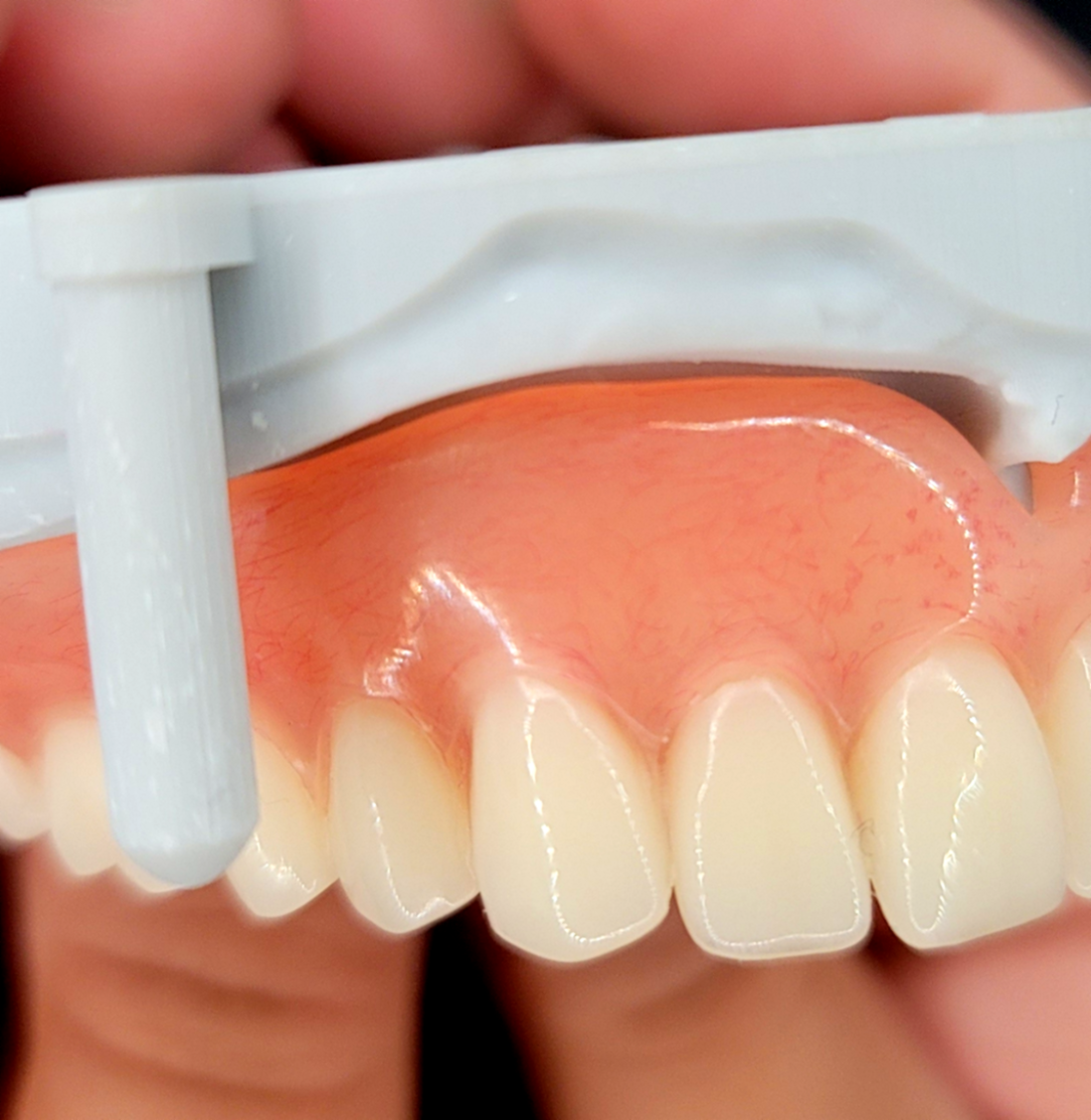 Close-up of a dental model showing upper teeth with a dental rubber dam and clamp for dental procedures.