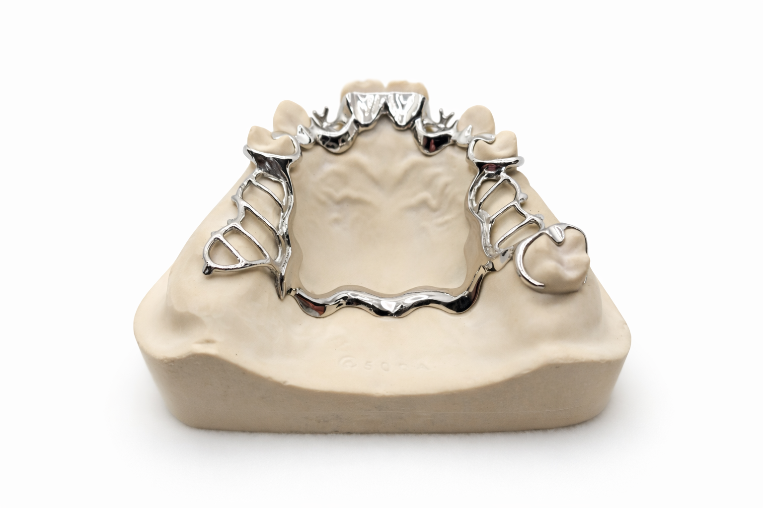 Dental cast model with a metal framework for a partial denture.