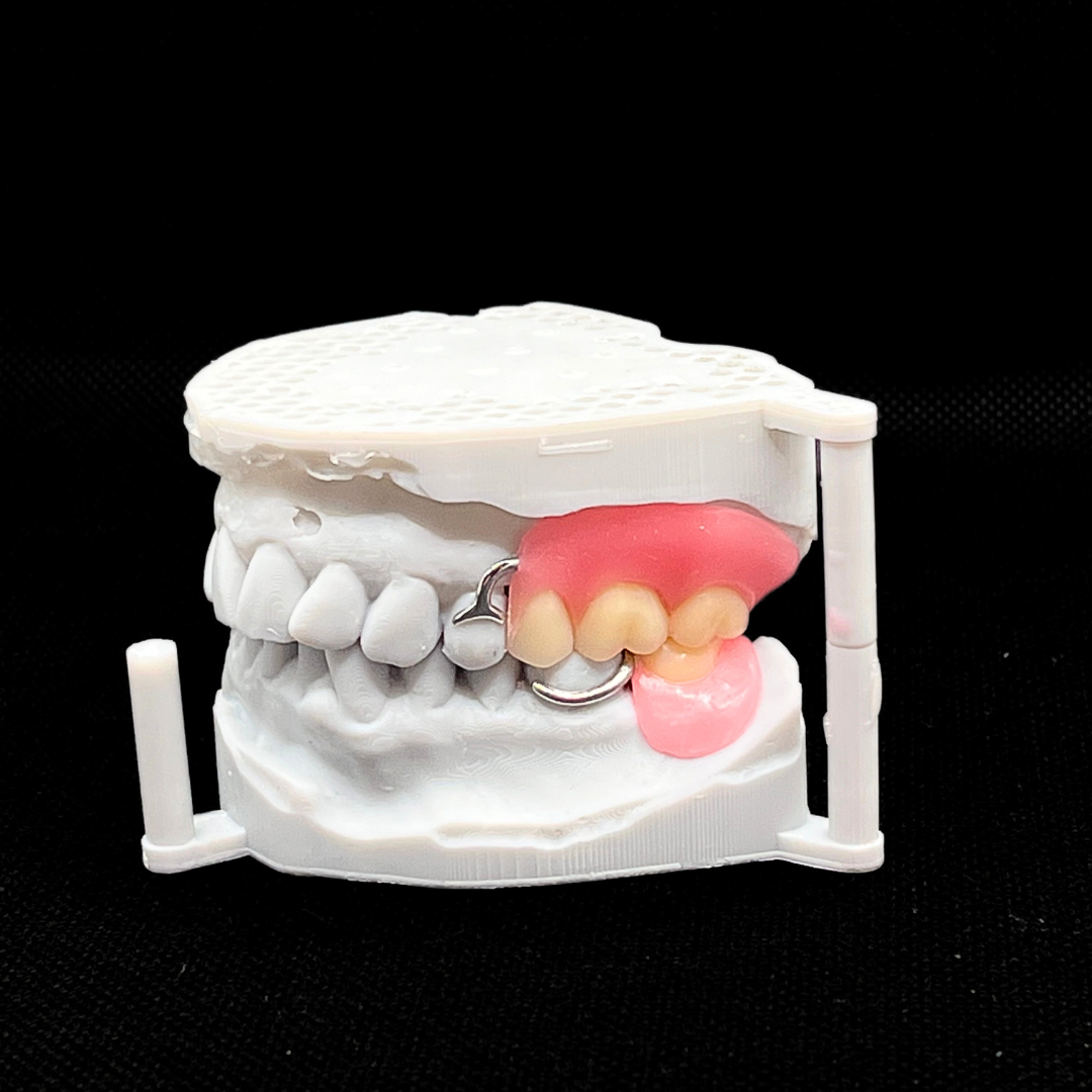 Partial w metal framework- 2.png