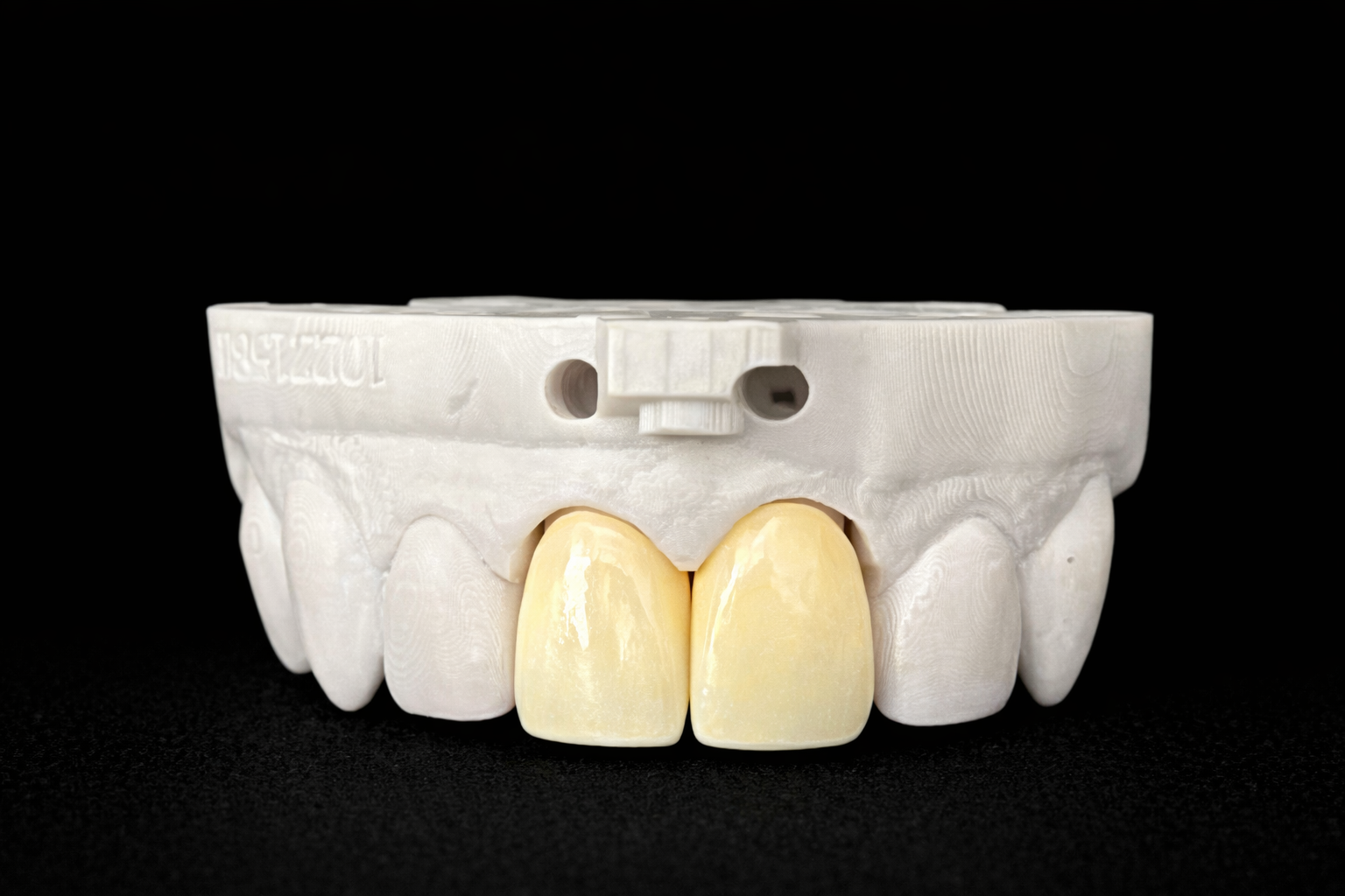 A dental model showing a white upper set of teeth with two yellow-colored front teeth on a black background.