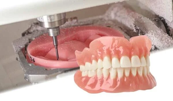 A dental prosthesis being manufactured in a milling machine.