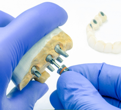 Dental technician working on a dental implant model with a dental drill.