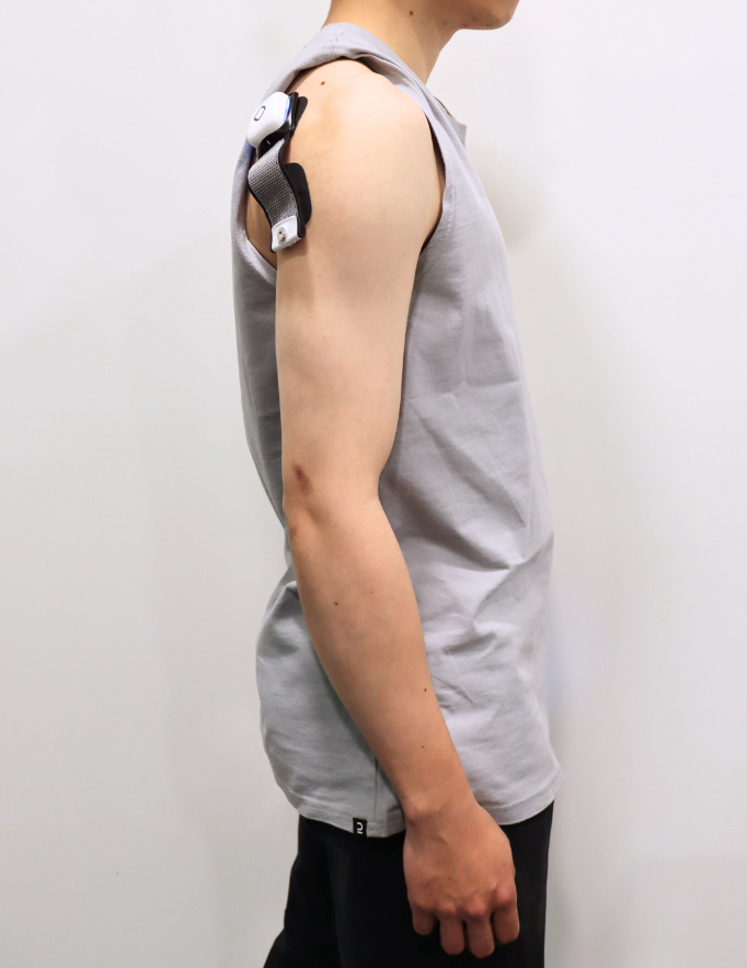 FES Electrode Placements for Upper Limb Stroke Recovery Vol.3 ...