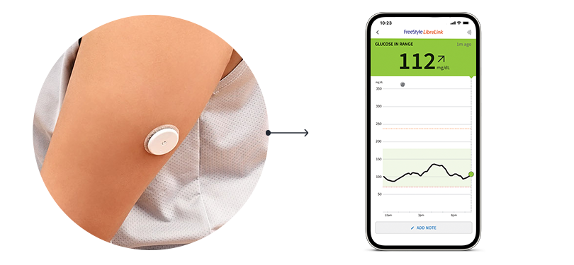 A person wearing a medical device on their upper arm, connected to a smartphone displaying a graph and a blood sugar level of 112 mg/dL.