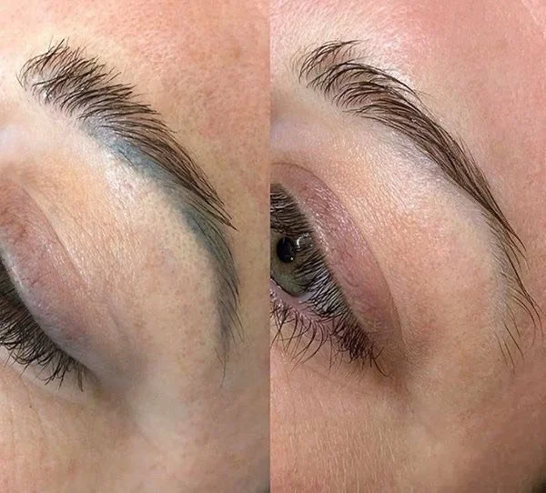 Permanent Make-up pigment Entfernung Berlin