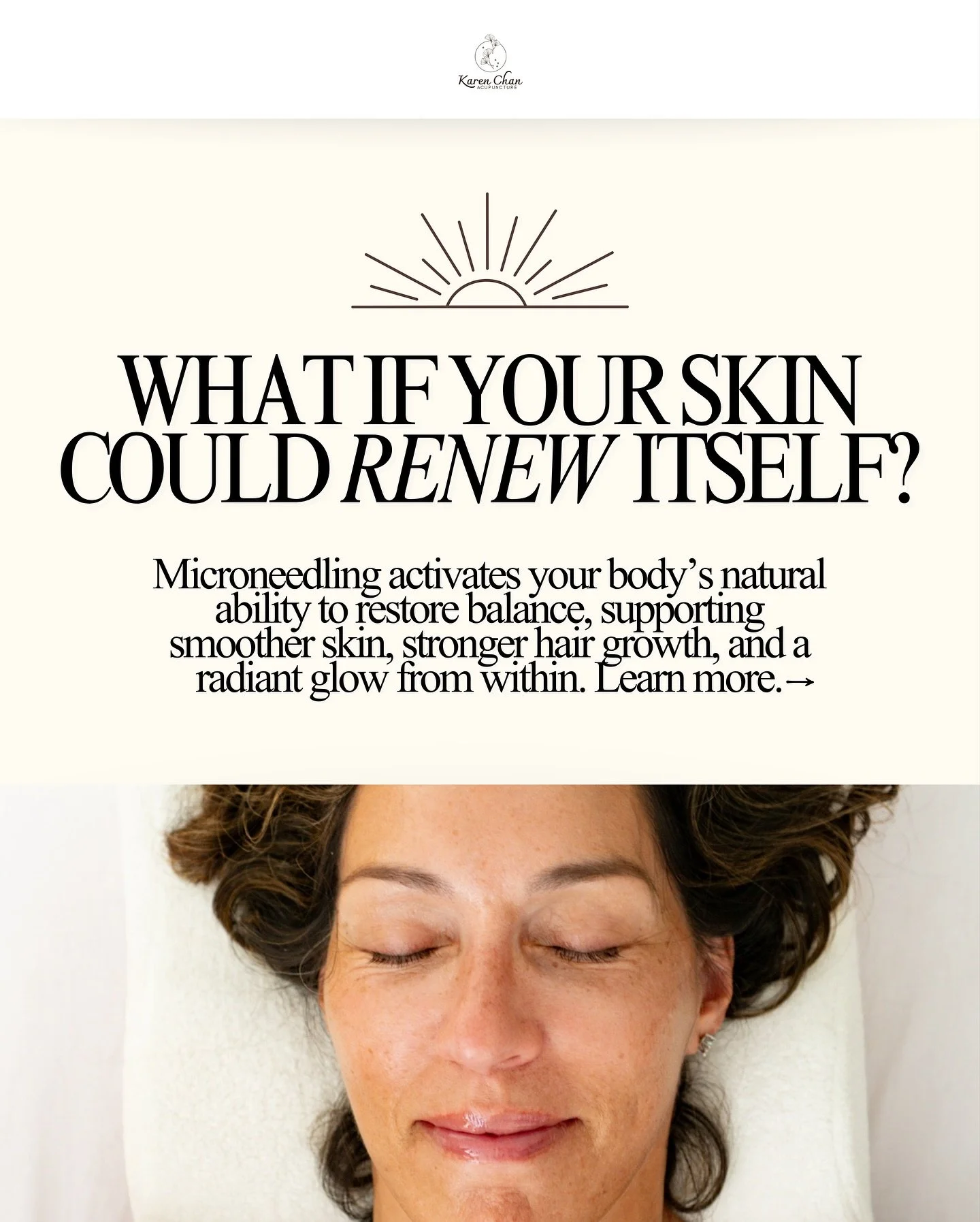 Just in! 🌿 Wednesdays are now open exclusively for microneedling sessions, beginning 11/5.

Not sure what microneedling is? Swipe through to see how this gentle treatment supports skin renewal and helps create a healthy foundation for hair growth. ✨