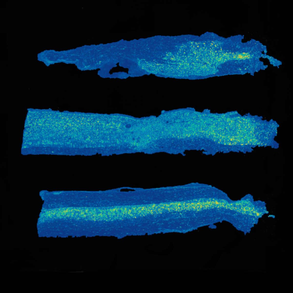 Stereo-seq mouse spinal cord
