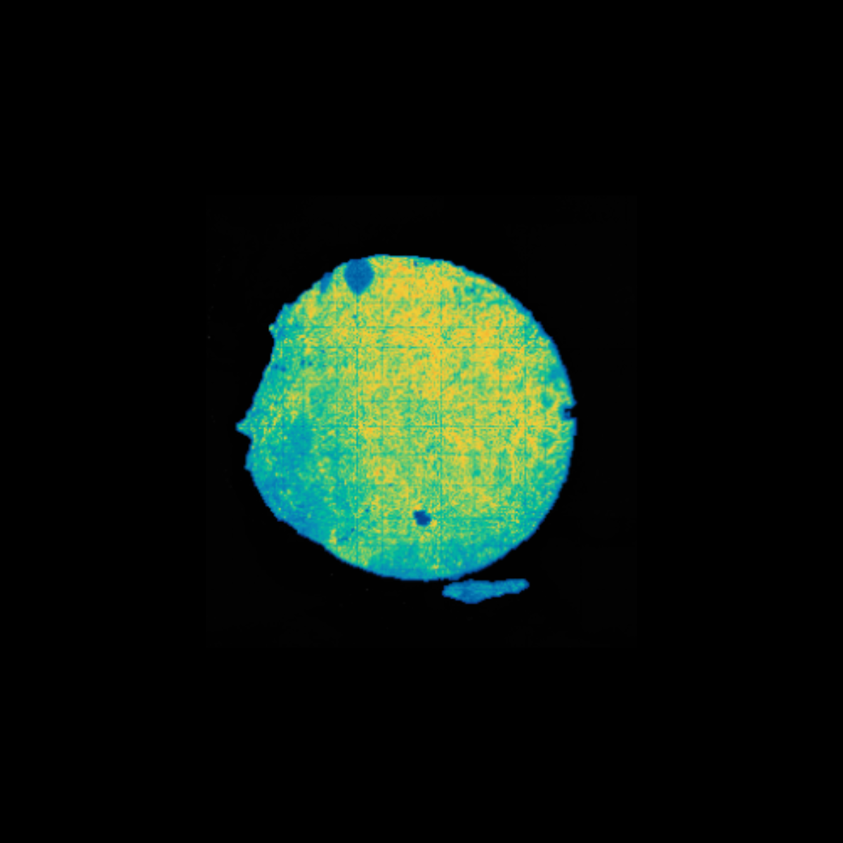stereo-seq FFPE gene expression human kidney