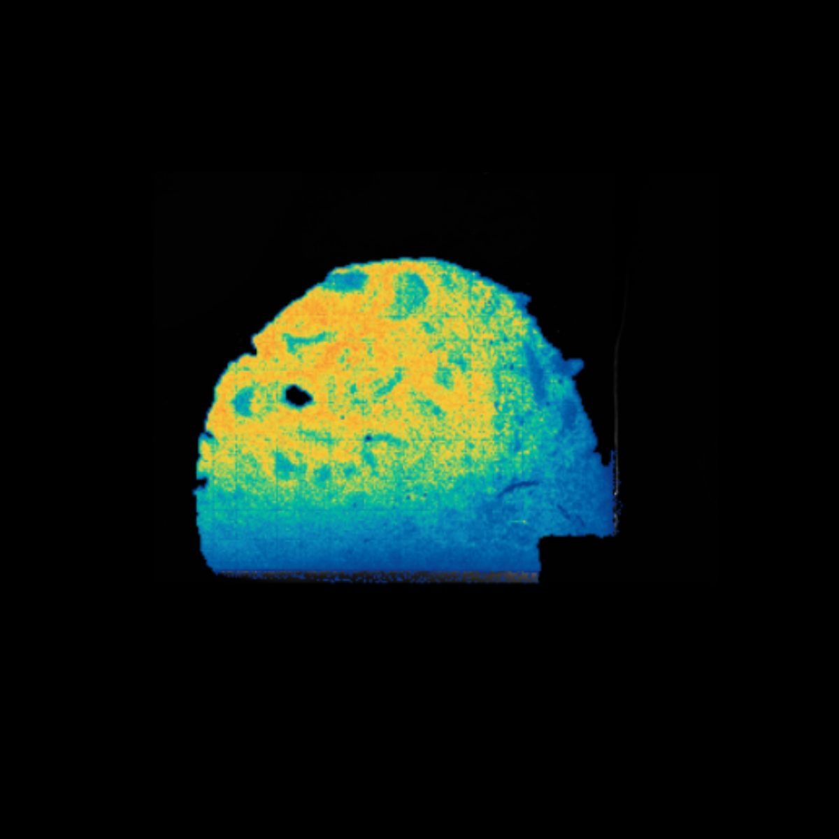 stereo-seq FFPE spatial gene expression human kidney