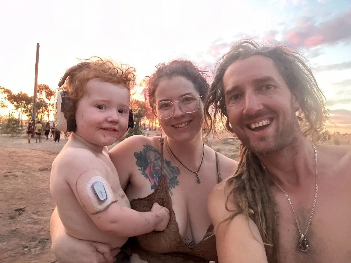 A happy family taking a selfie outdoors during sunset. The family consists of a young child with a medical device on their arm, an adult woman with glasses and tattoos, and an adult man with dreadlocks. The background shows trees and a colorful sky.