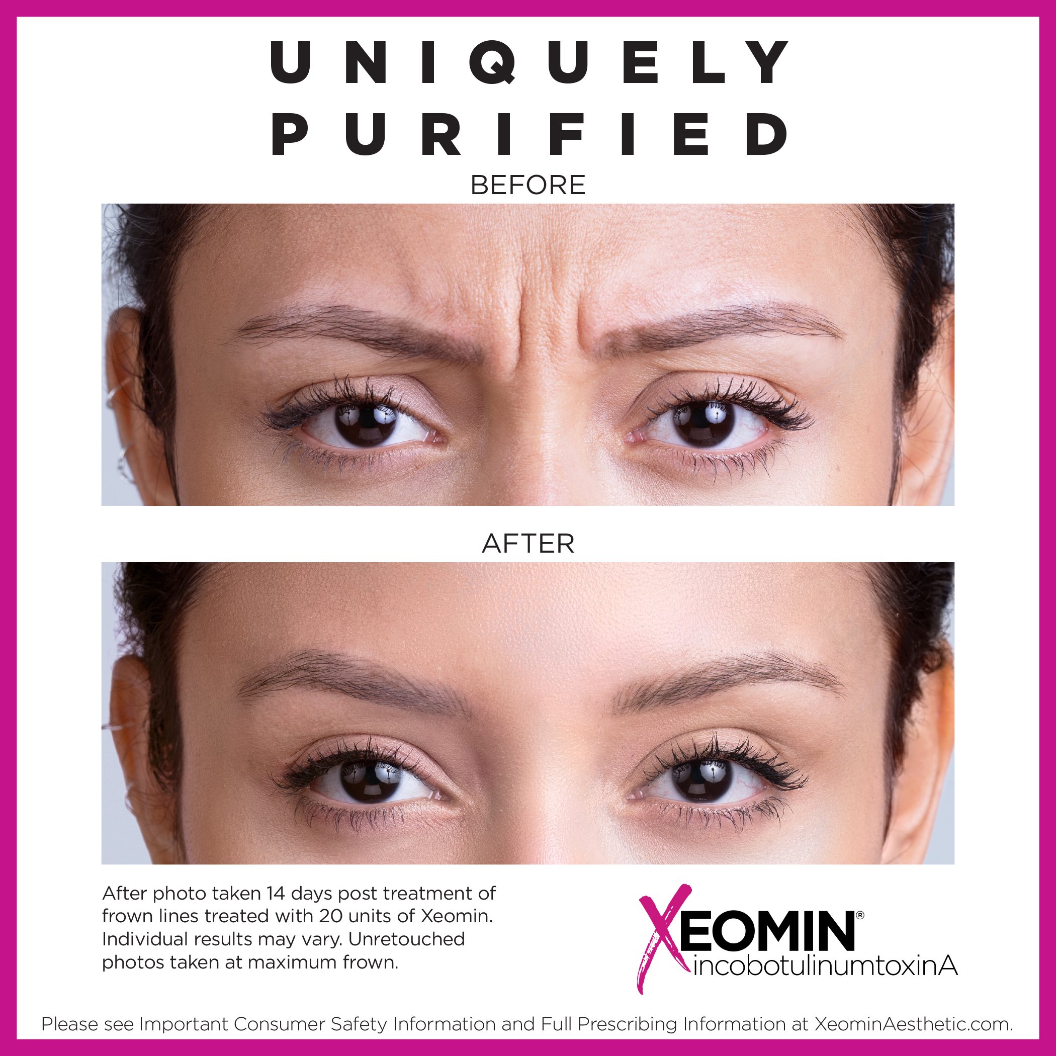 B&A-vertical-astrid-14-day.jpg