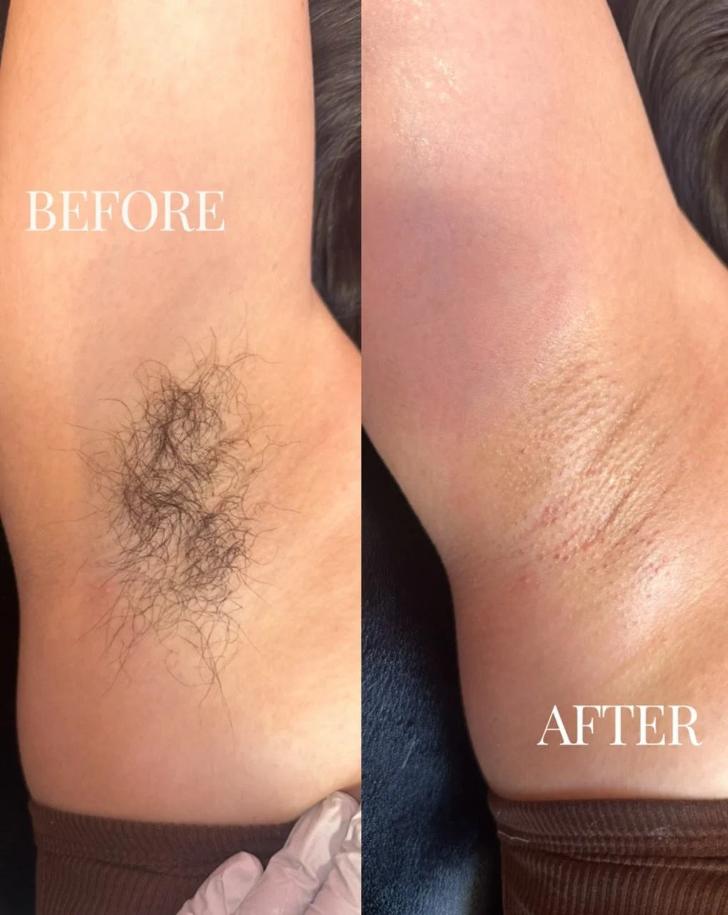 Nothing quite like smooth underarms! We are obsessed! Book your wax today ✨💌

#utahwaxer #waxing #brazilianwax #slcwaxer #utahesthetician