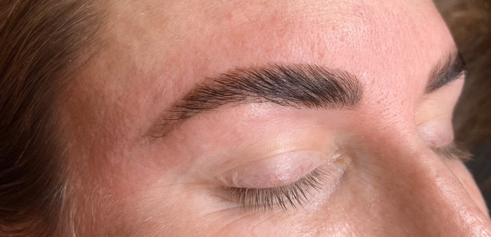 HAAN Aesthetic Medicine_Bozeman_Results-Brow After.jpg