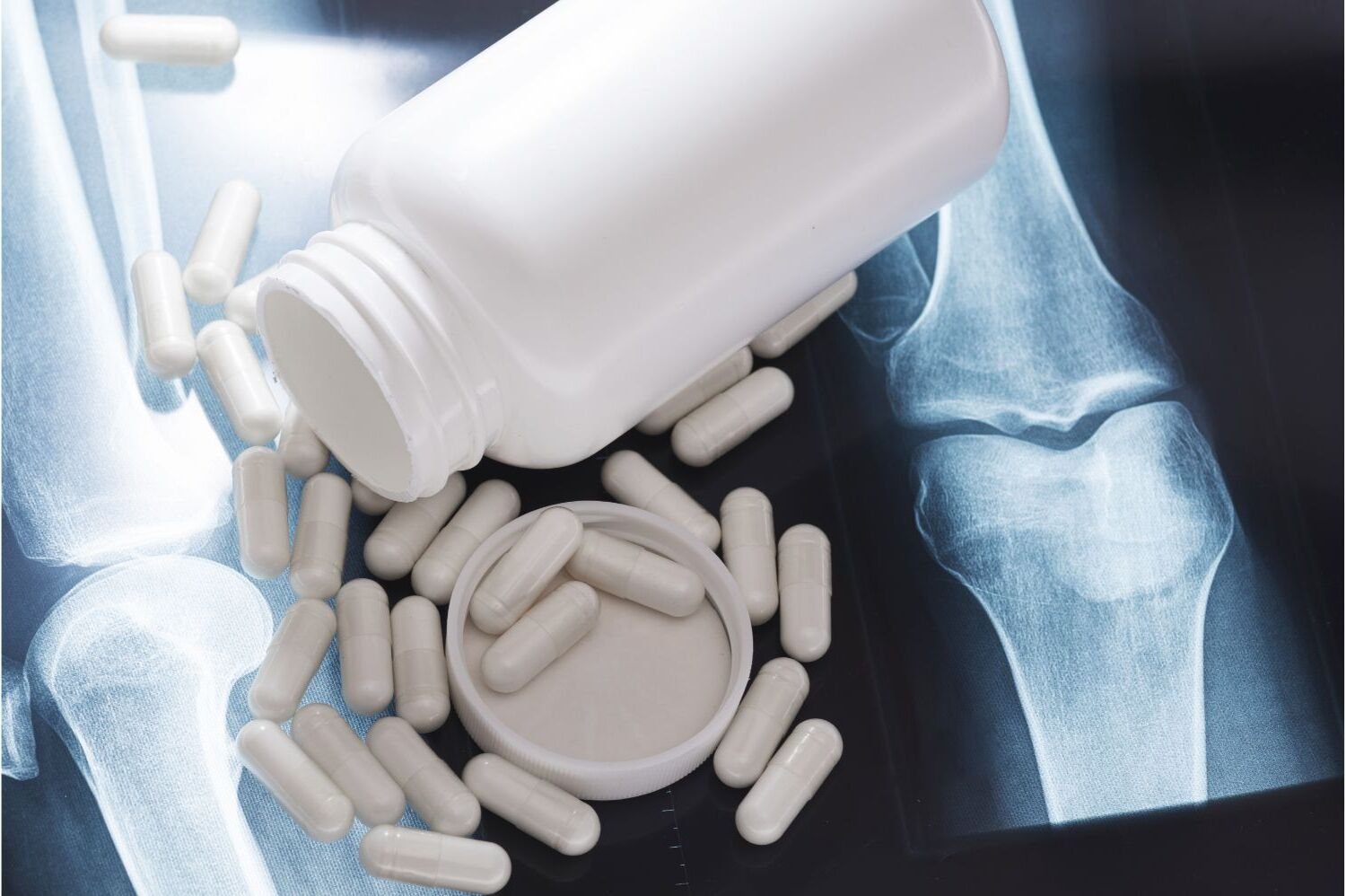 Boost Your Joint Health with Glucosamine Formula for Confidence and Comfort