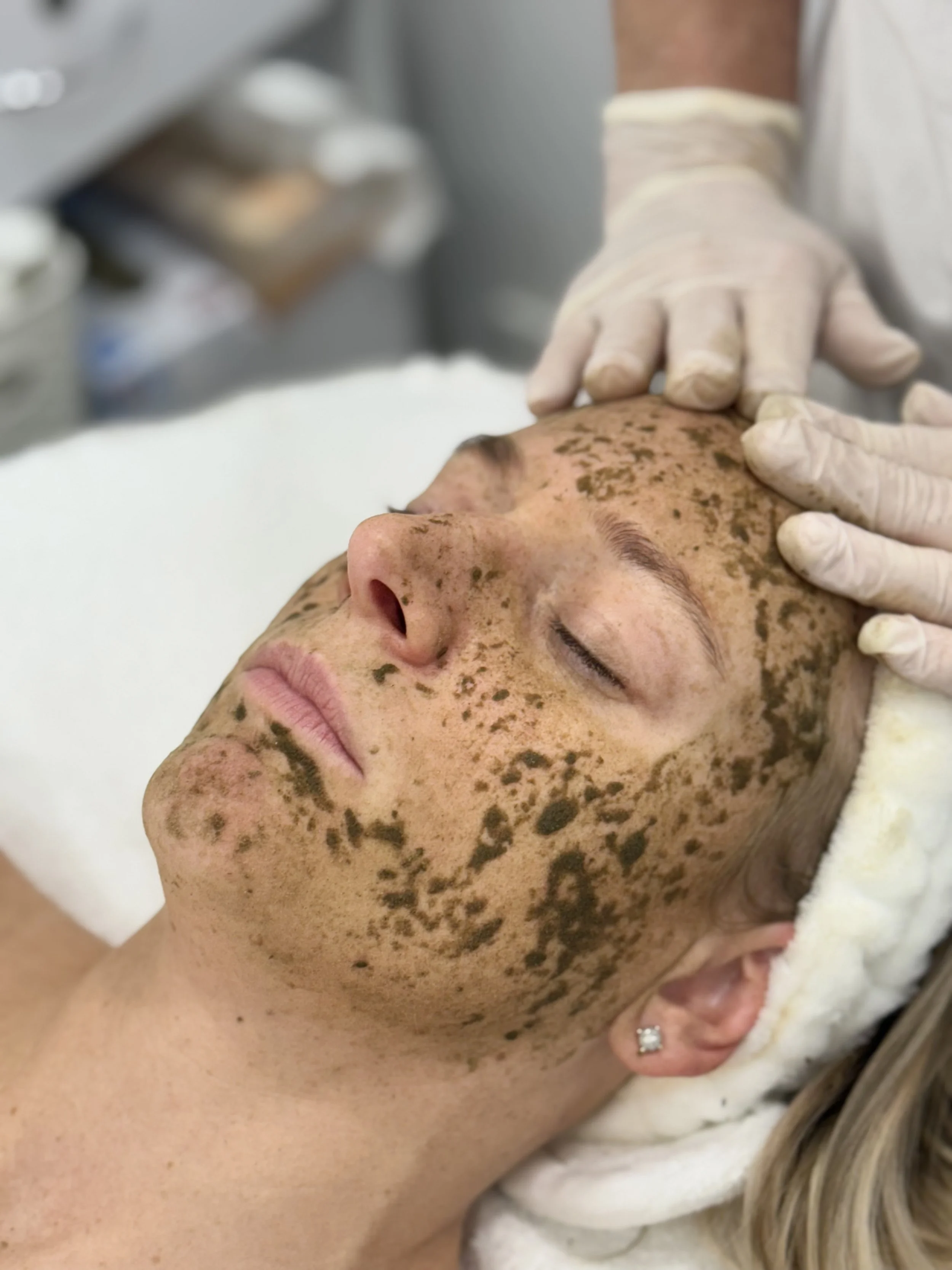 Client with radiant skin after a Dr. Esthè treatment at Beaches Beauty Avalon