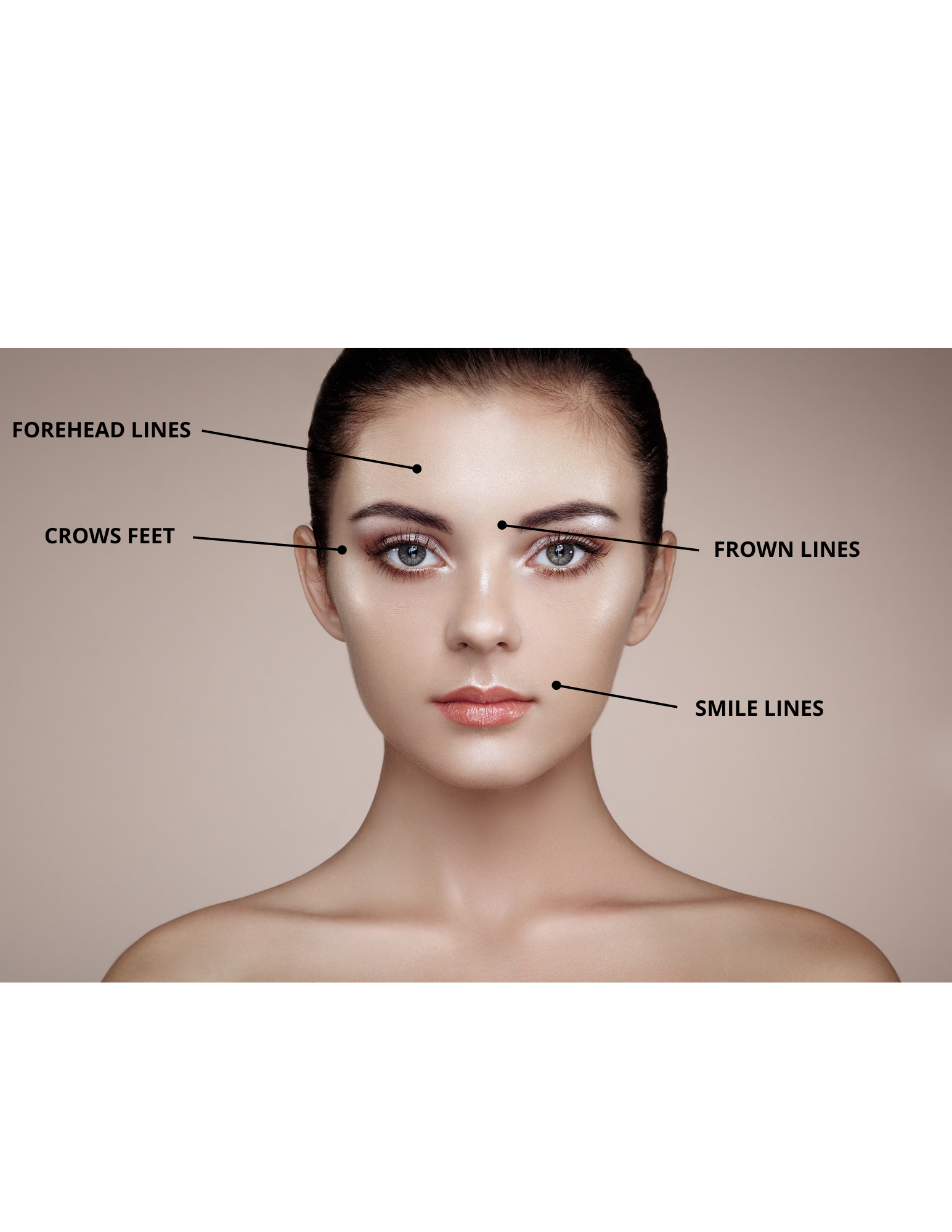 Botox en Dentistería