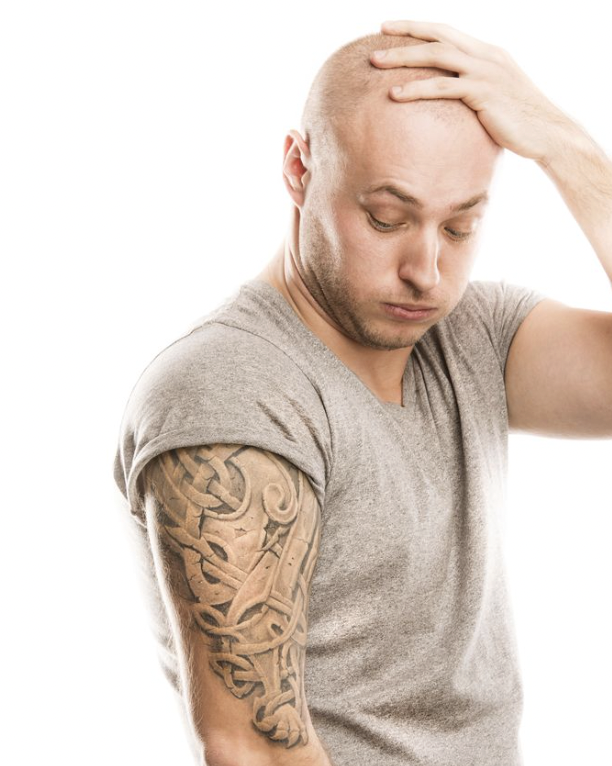 Tattoo Regret: Why people are removing them. 