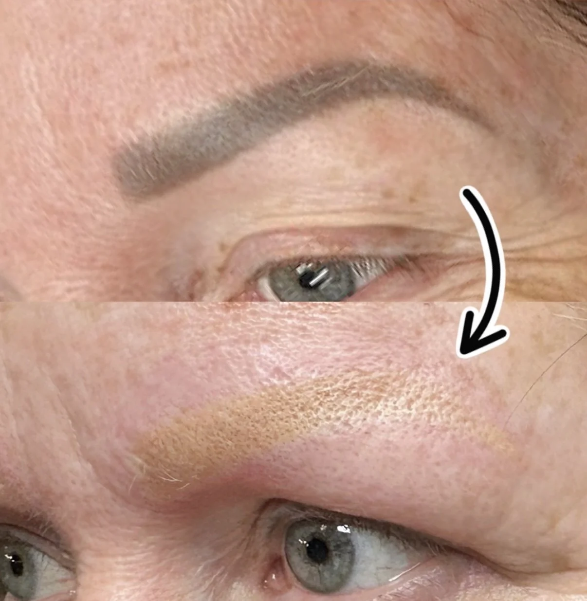 Why do some brows turn yellow after removal?
