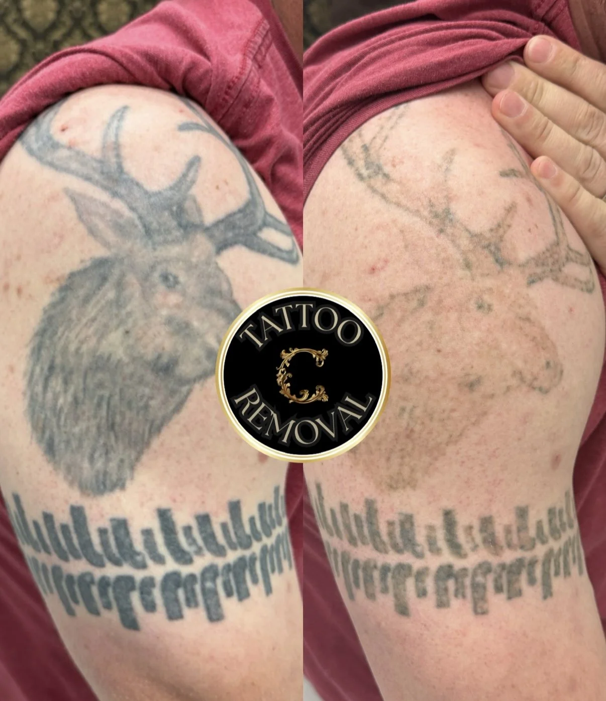 Why we wait 8 weeks between sessions