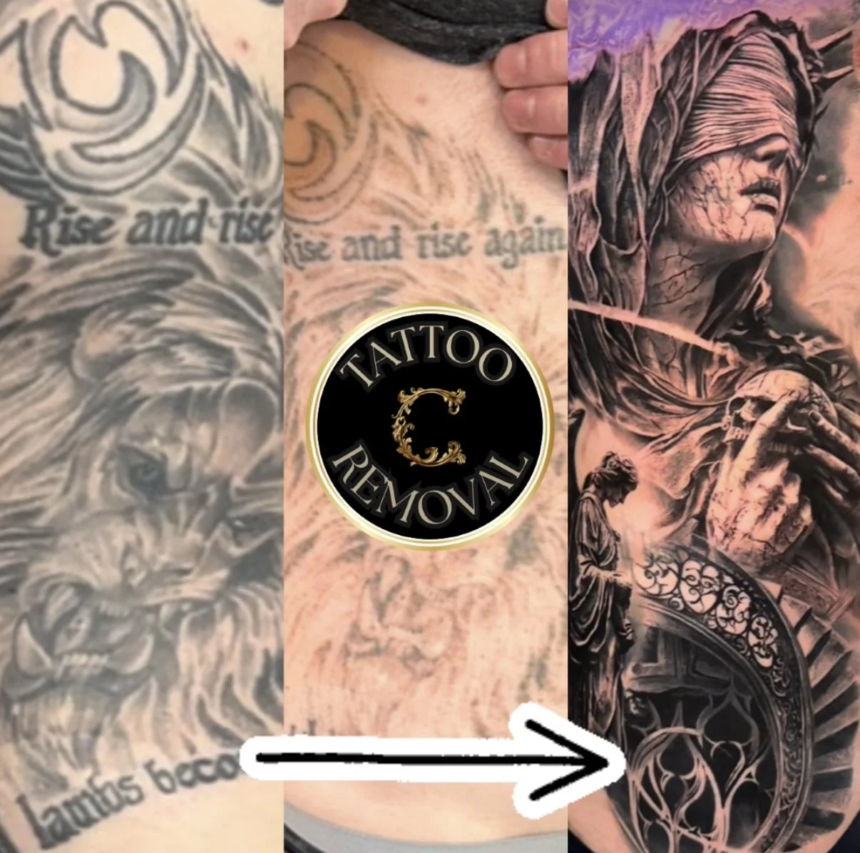 Make room for new tattoos