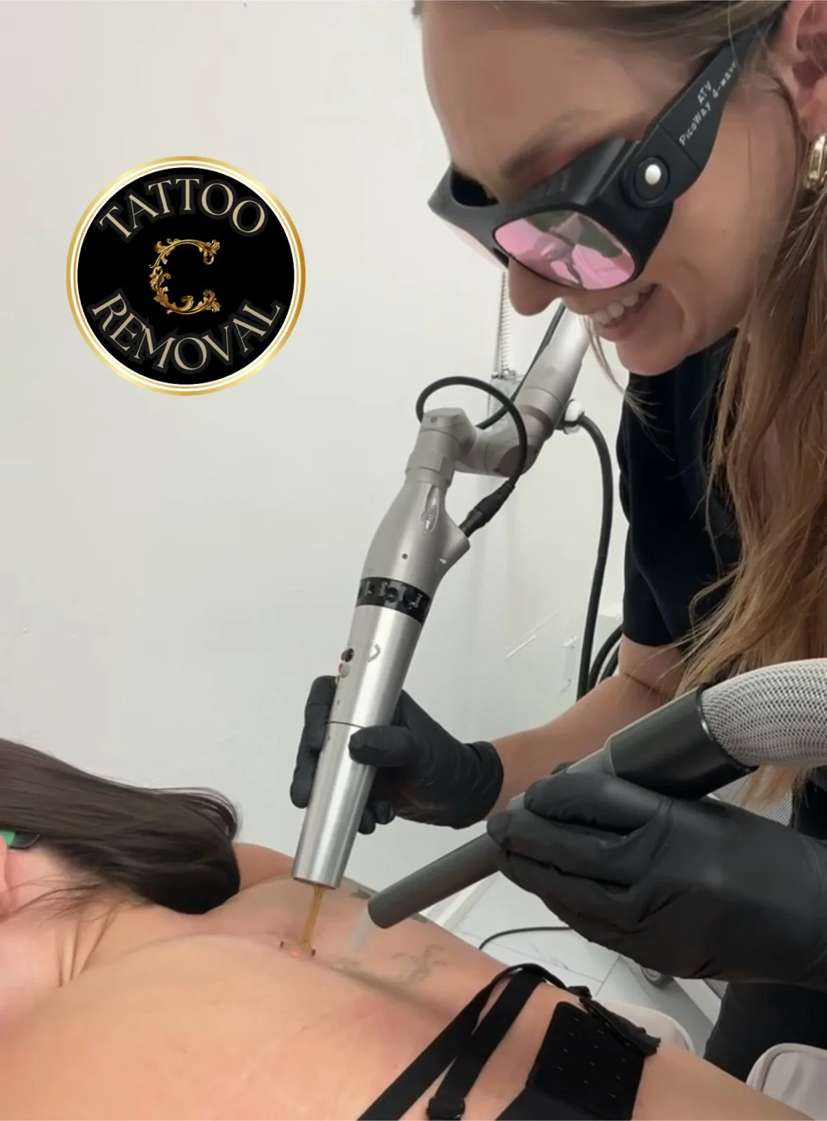 Is tattoo removal safe? 