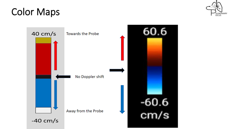 Color Doppler Velocity Mode — Pulmonary POCUS