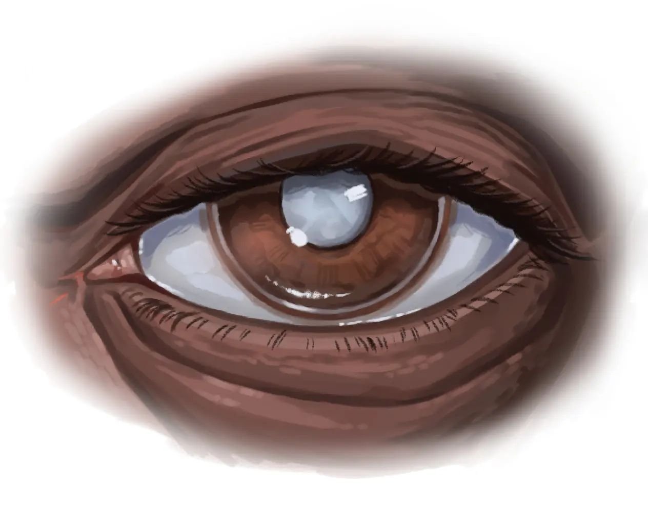 An eye with a cataract that I painted while working on the Diversity Fellowship. It did not make it to the final draft, but I still love the way it came out!
.
.
.
.
.
.
.
.
.
.
#medicalillustration #eye #cataract #visual #scienceillustration #illust