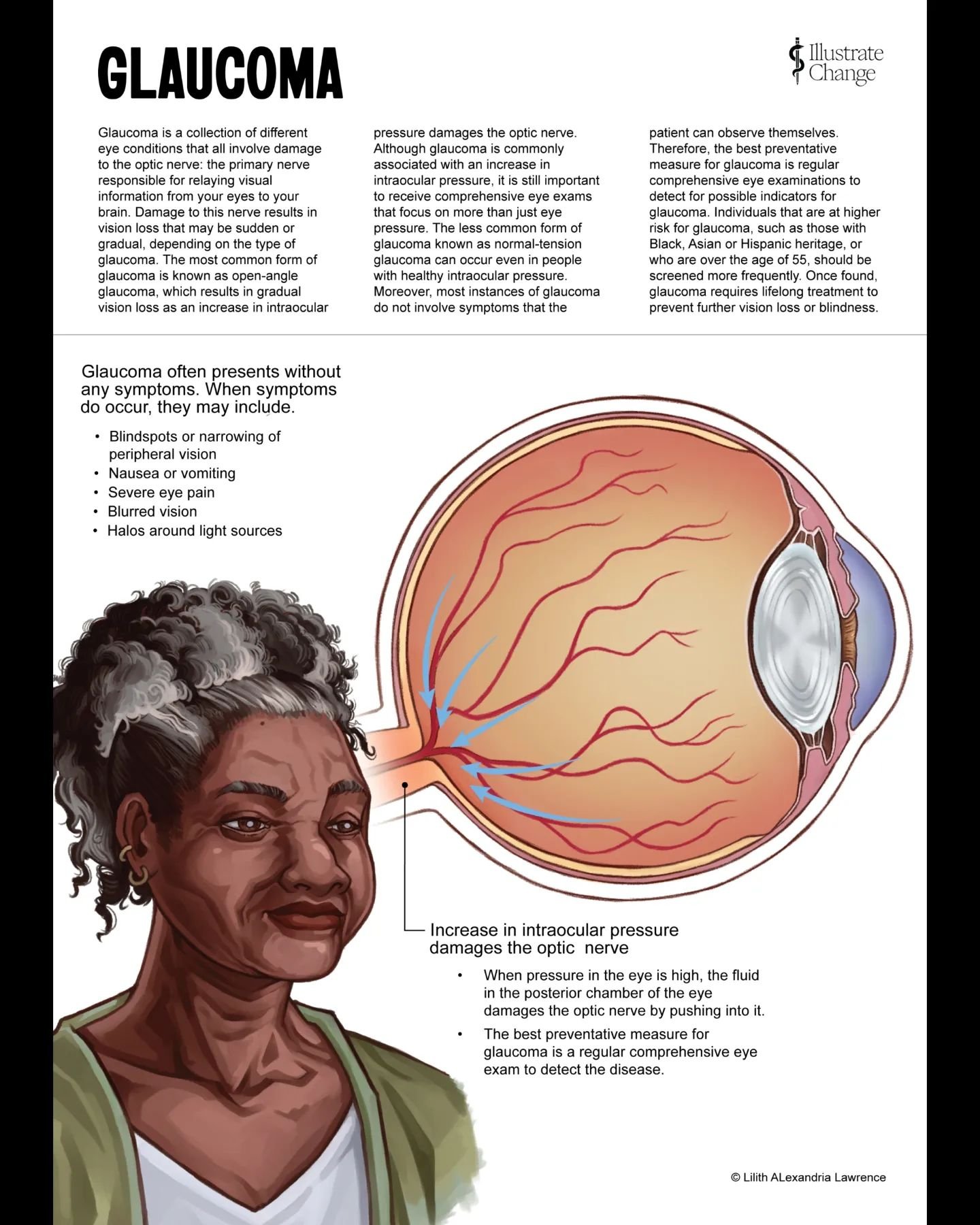The fourth illustration I created for the AMI Diversity fellowship is a piece on #Glaucoma.
This piece represents my first time illustrating eye anatomy, and thus, I was excited to get some experience in this area. I hope to work with the eye more i