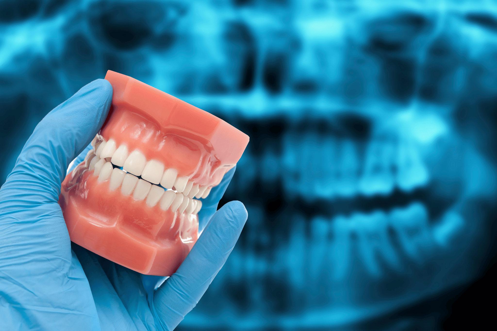 What Is an Open Bite? Causes & Treatments