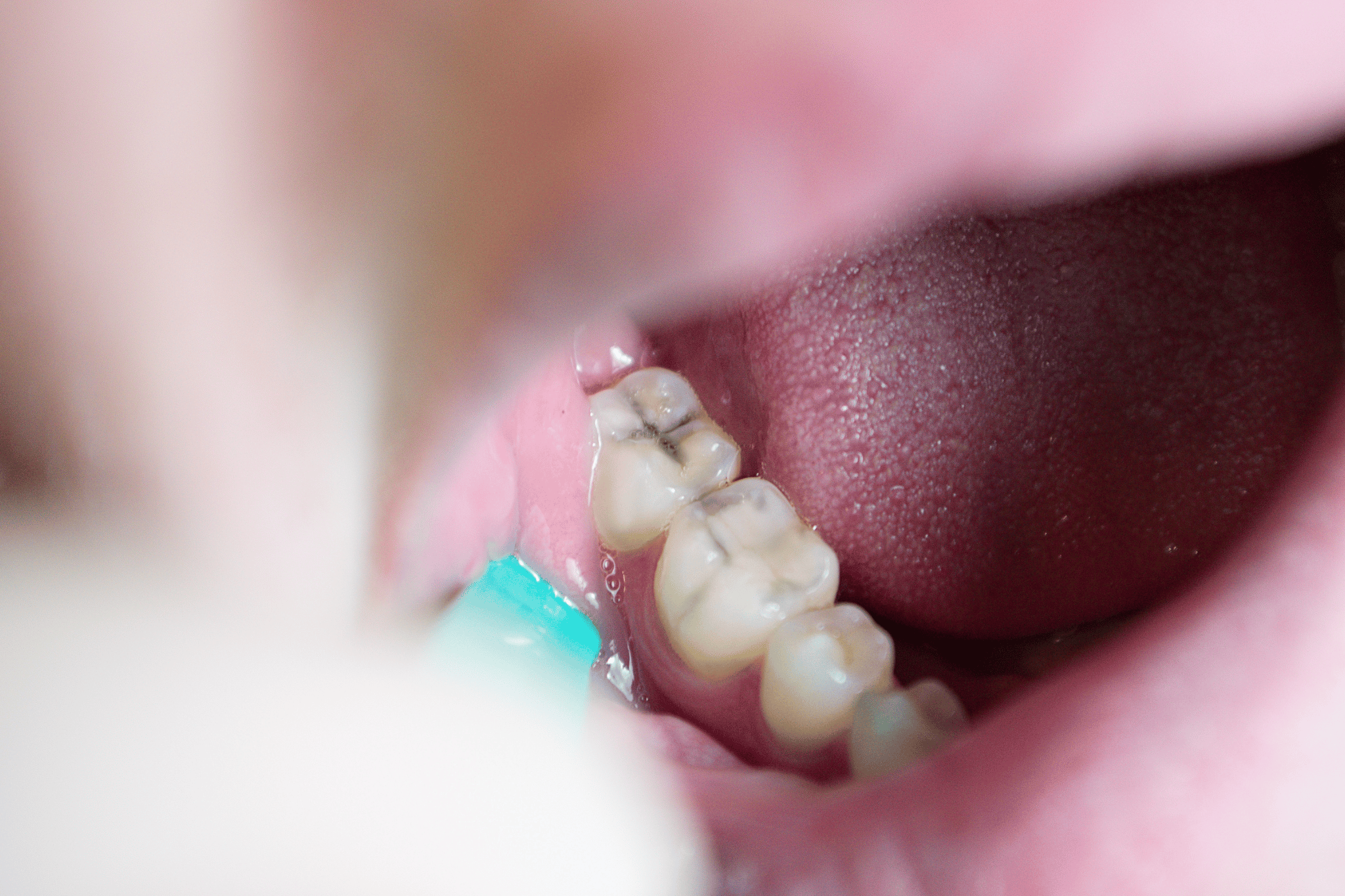 What Happens When You Delay Dental Treatment?