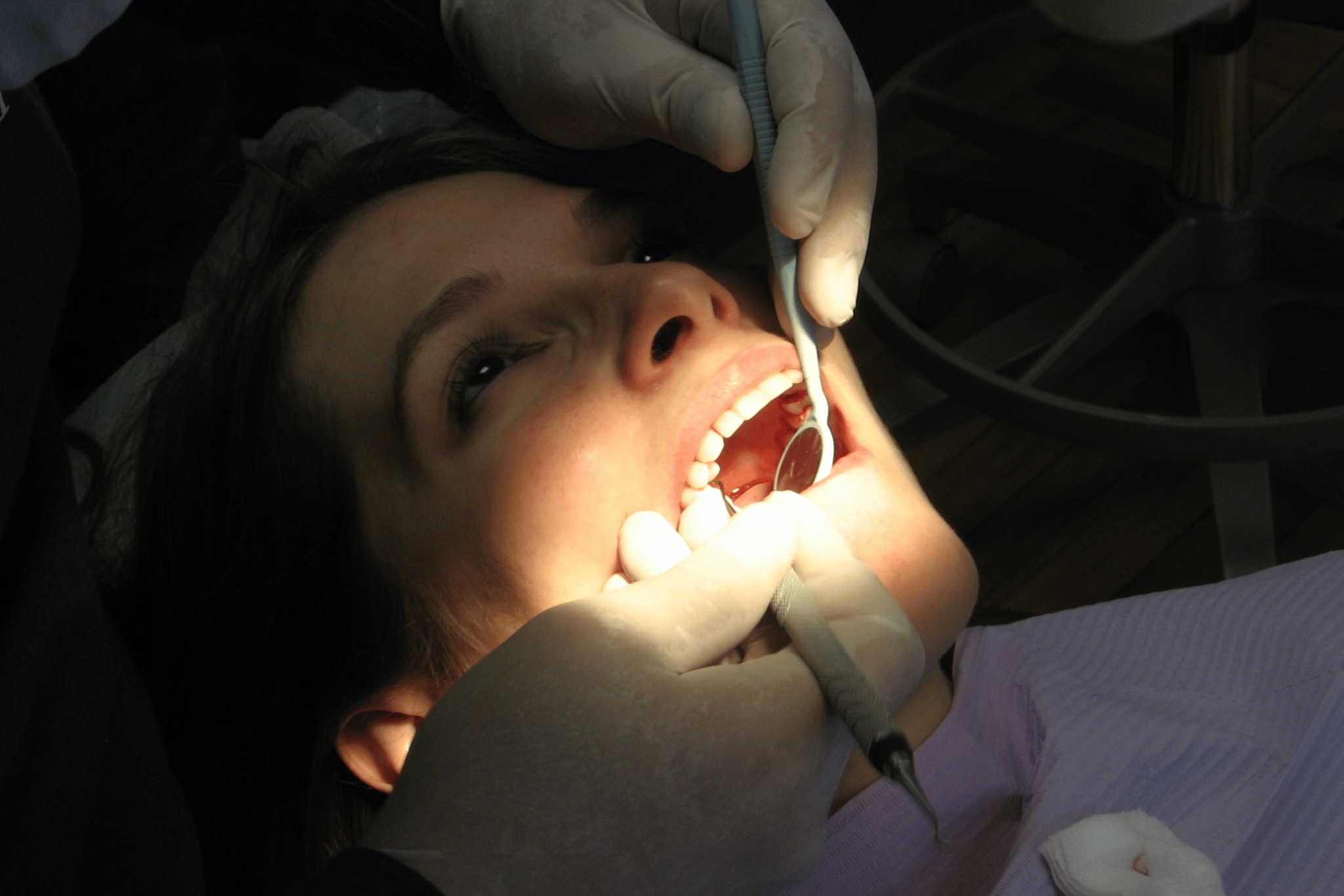 Treatment for Tooth Nerve Pain