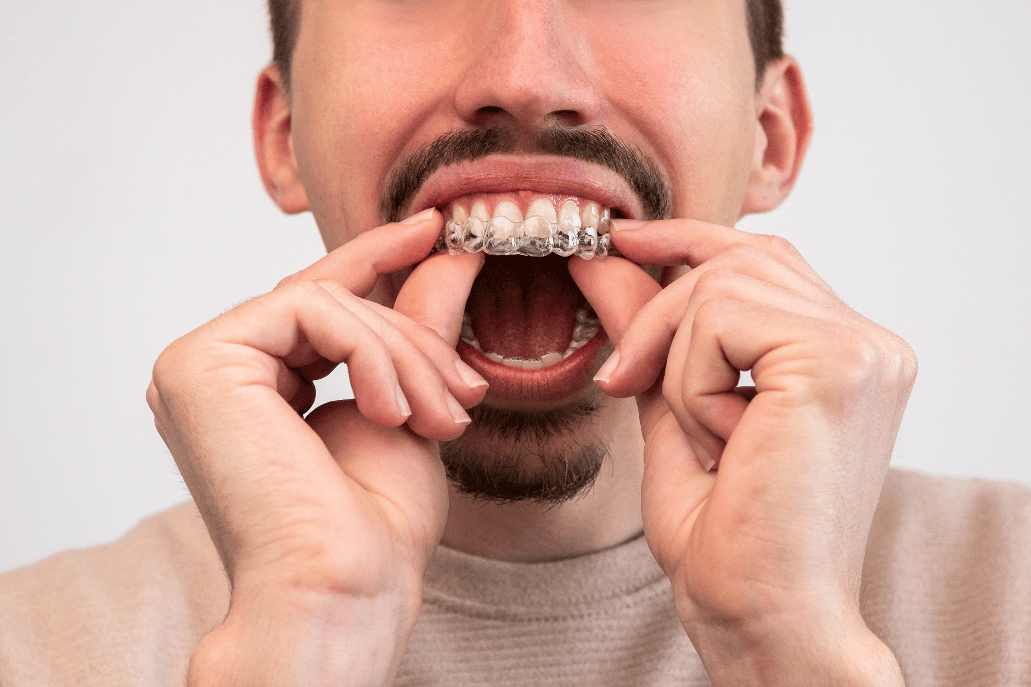 Open Bite Treatment and Correction Options