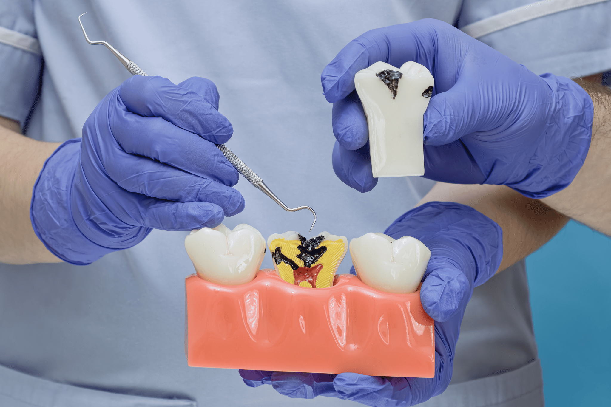 What Causes Nerve Pain in a Tooth?
