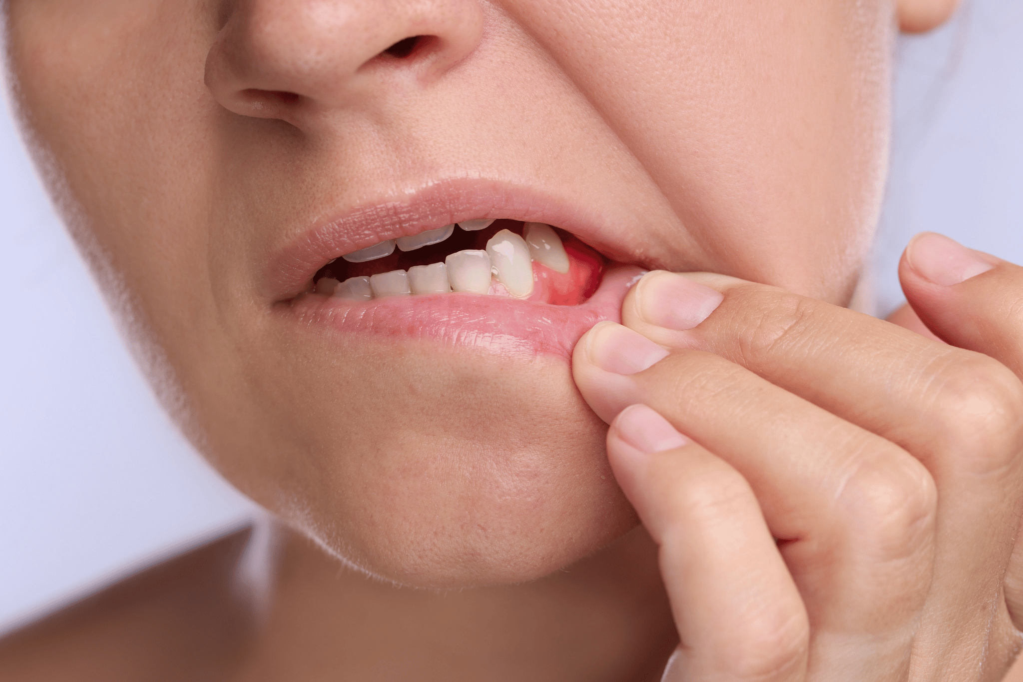 Why Are My Gums Bleeding? Causes & Treatment