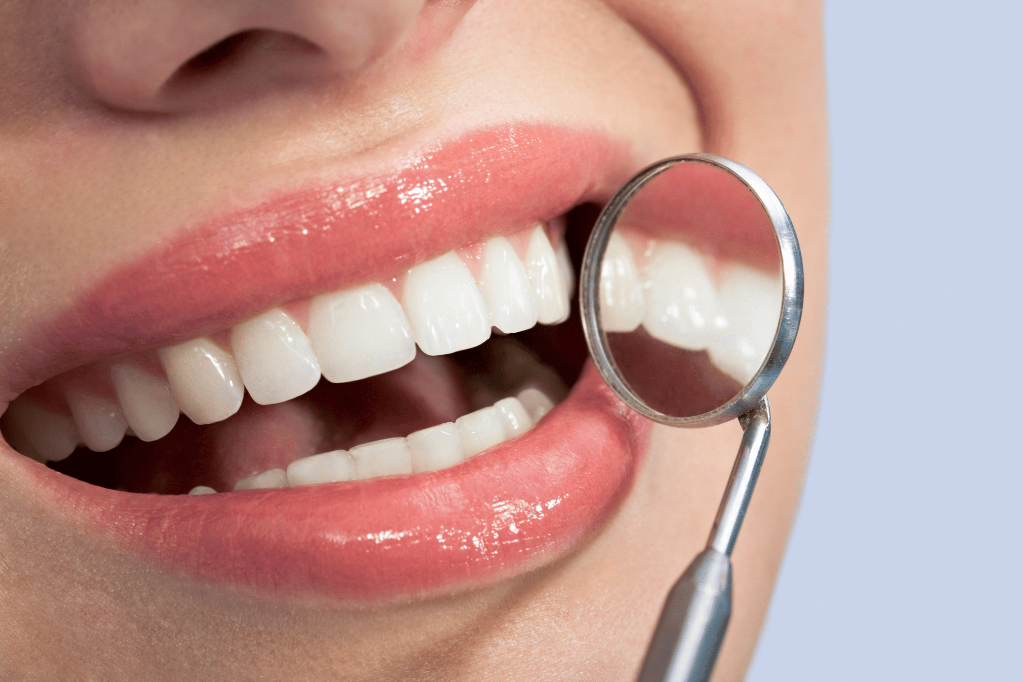 White Spots on Teeth: Causes & Treatment