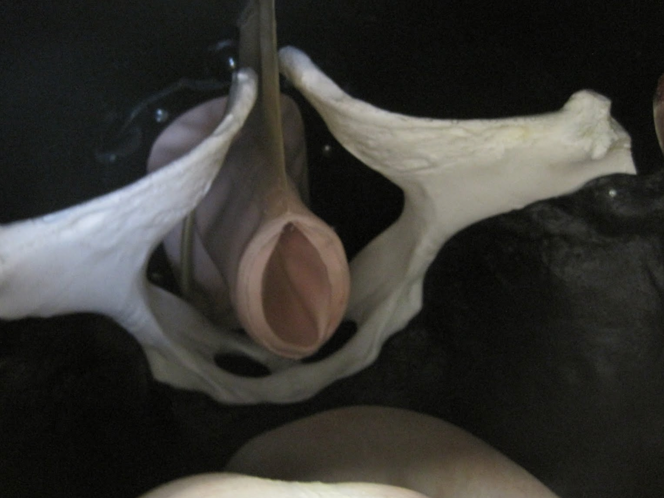 Interior view of the pelvis and inflatable rectum, with supporting membrane.