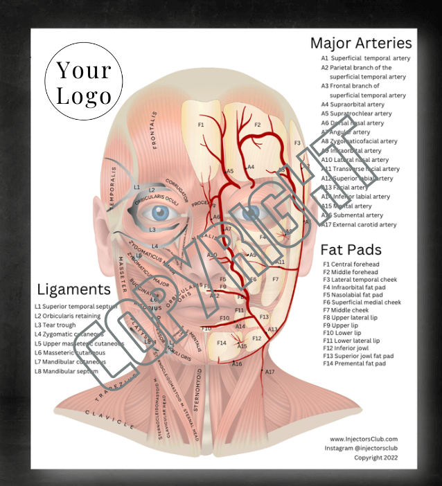 Acrylic Board — Injector's Club