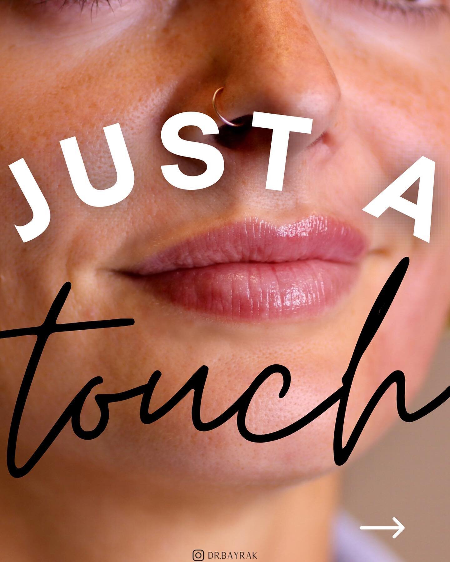 Patients often use the phrase &ldquo;just a touch&rdquo; 🤏🏼 to describe the amount of lip augmentation they want, but that can mean something very different to different people. In this case, the goal was to recreate the hydration and plumpness of 